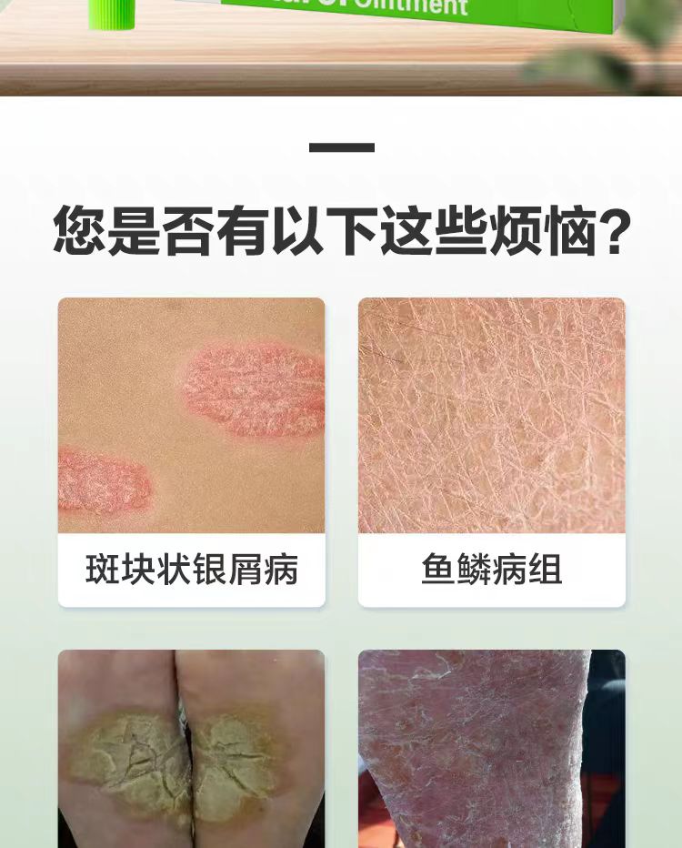 日本maruho特效牛皮癣 结痂 发红 皮疹软膏（2027.08）