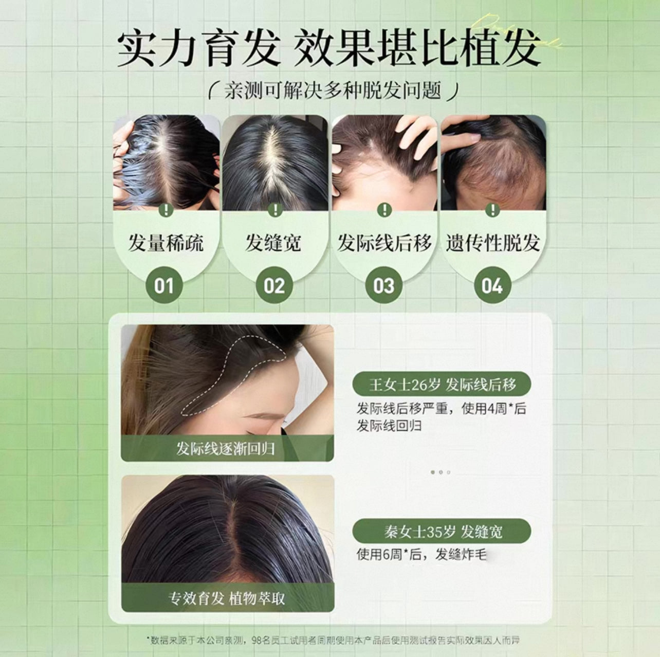 Yanagiya Hair Tonic Methol Rich 柳屋 防脱发头皮营养液 薄荷香 240ml