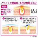 日本KOBAYASHI小林制药 手臂鸡皮角质软化毛囊药膏 30g（保质期：08/28y）